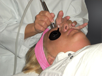 Dermabraze zkrok