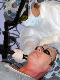 Operan frakn CO2 laser